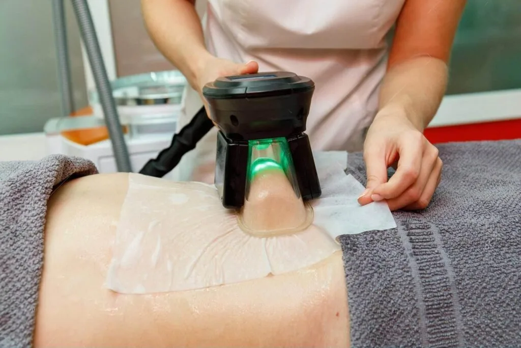 The Best Fat Freezing Machines for Sale: Expert Buying Tips